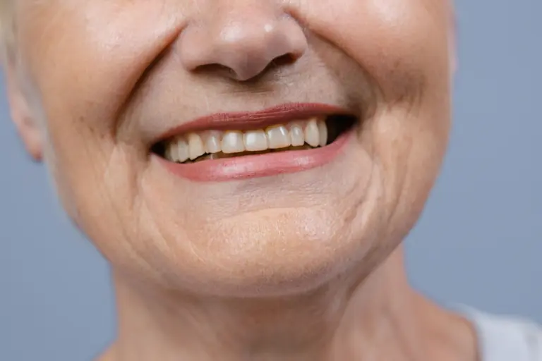 A detailed close-up of a senior woman's smile showcasing her natural teeth and wrinkles.