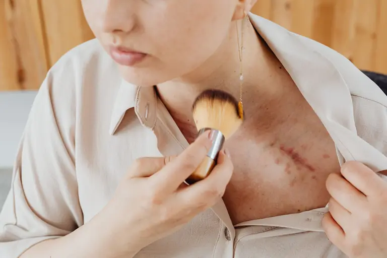 Close-up of a woman using a brush to cover a chest scar with makeup.