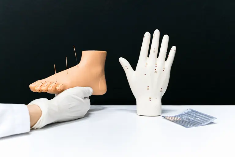 Acupuncture models of a hand and foot with needles, showcasing alternative therapy techniques.