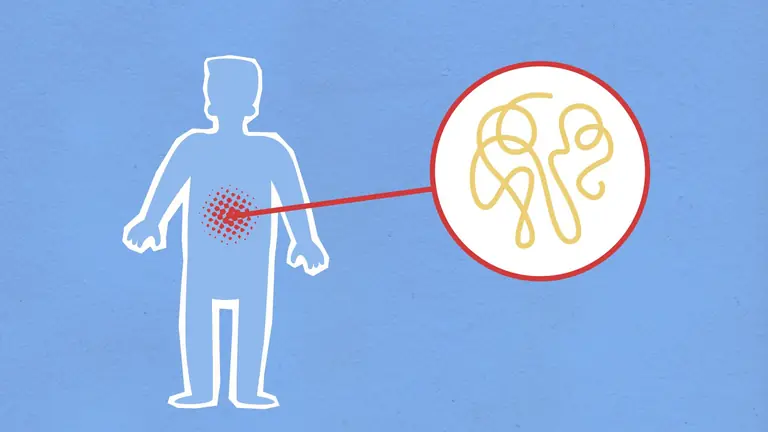 Cutout paper composition representing sick human figure with viral infection in stomach on blue background