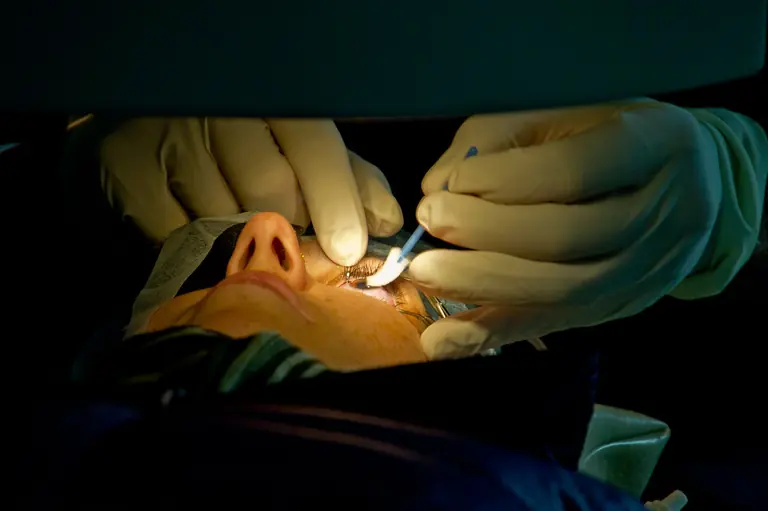 Lasik : Laser Eye Surgery
